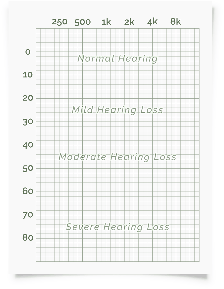 Hearing Banana Chart